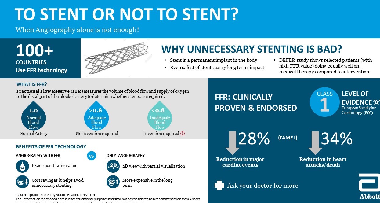 Getting a Heart Surgery - What You Should Know