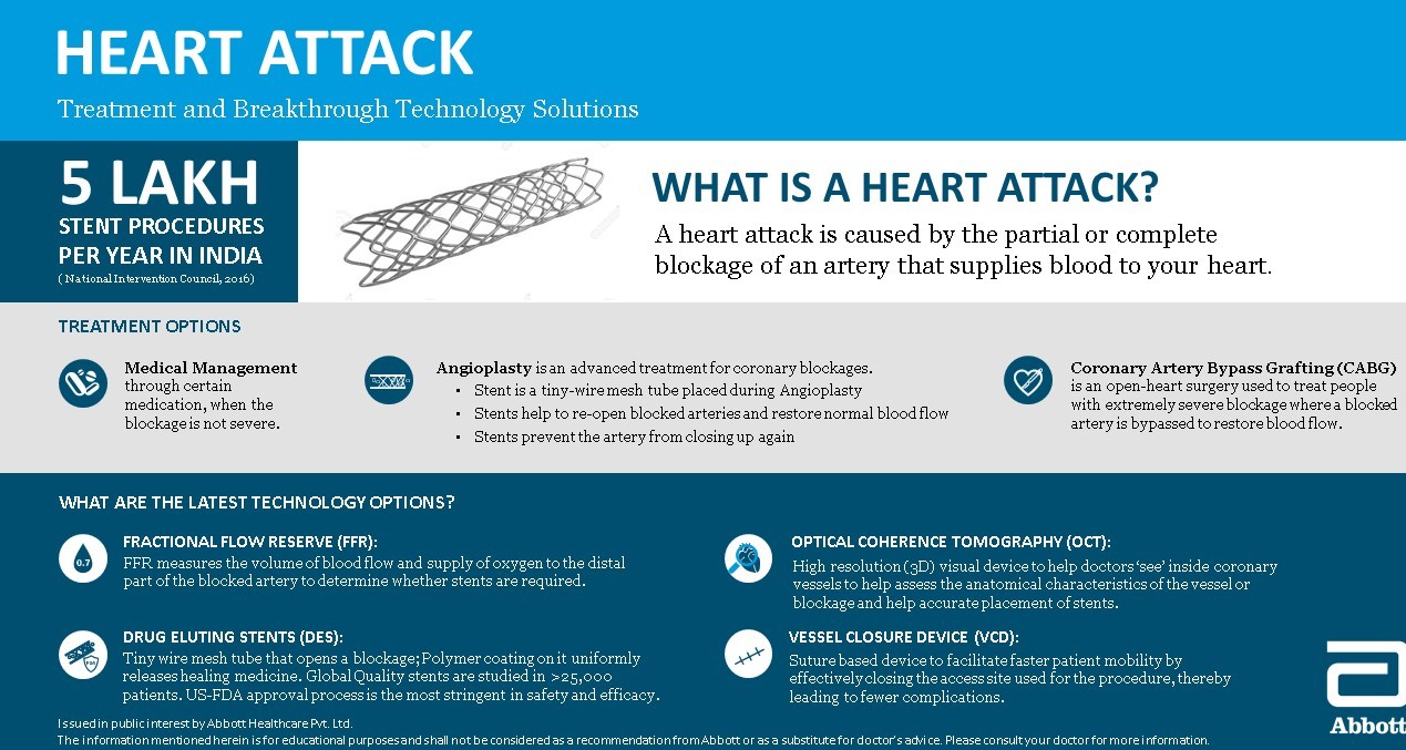 Getting a Heart Surgery - What You Should Know