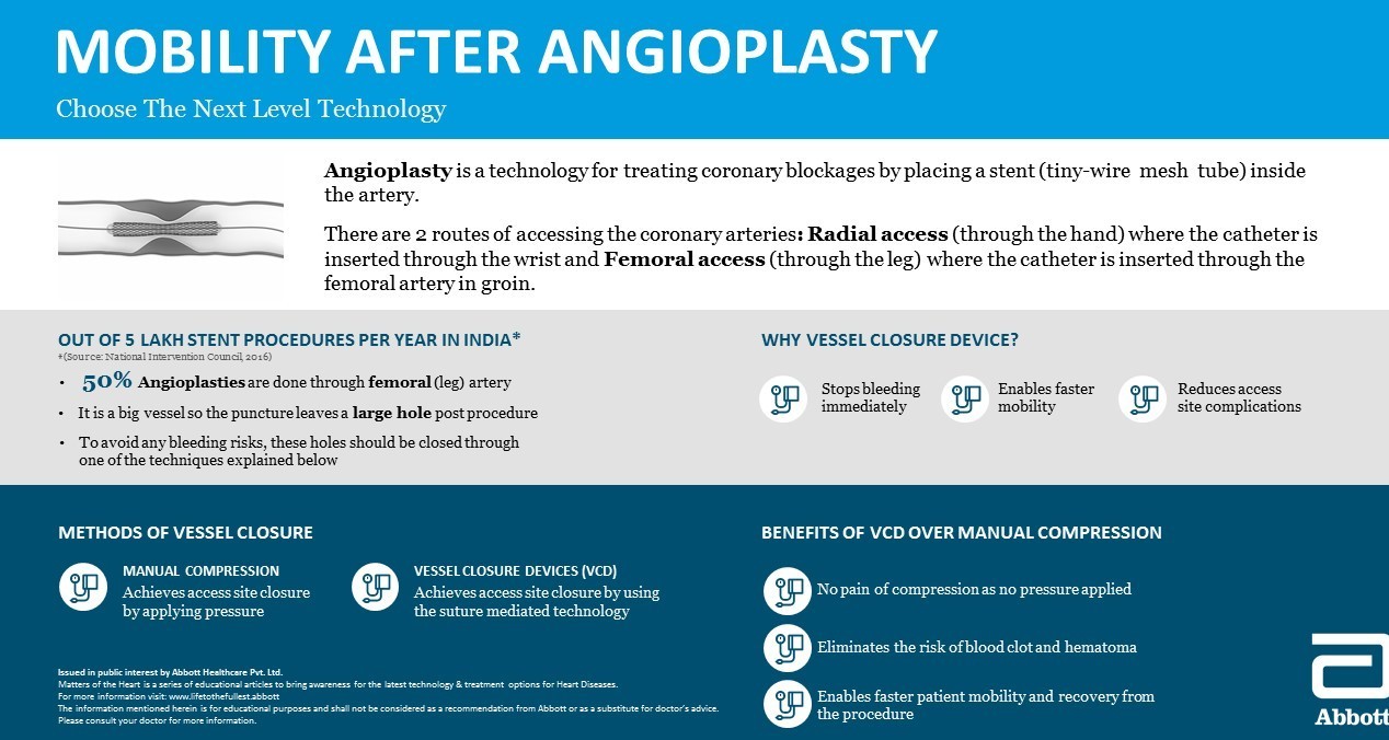 Angioplasty Recovery Time: The Do's and Don'ts
