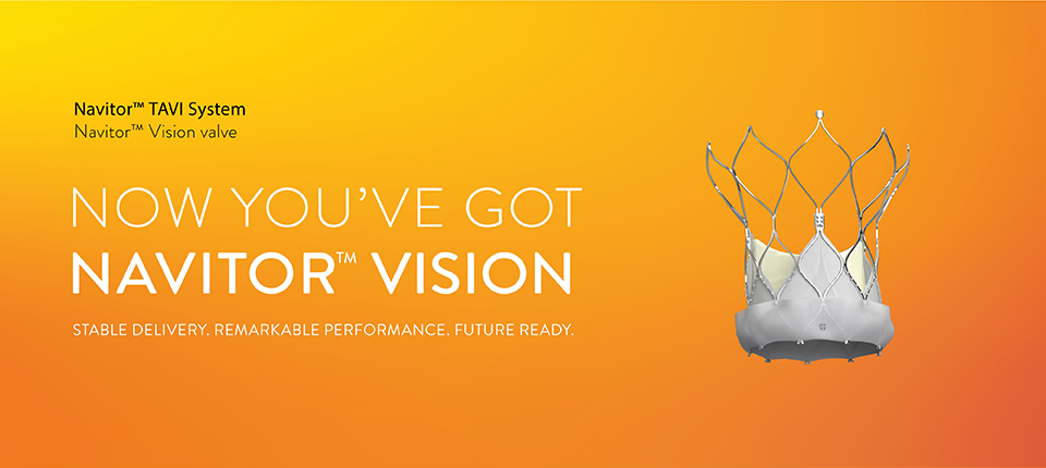 Abbott’s latest Navitor™ Vision